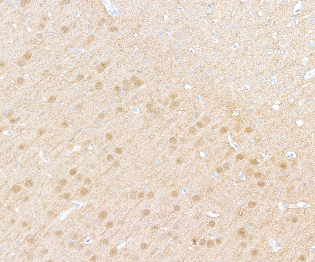 Immunohistochemistry - Anti-UCHL1 antibody [BLR216K] - BSA free (AB314058), expandable thumbnail