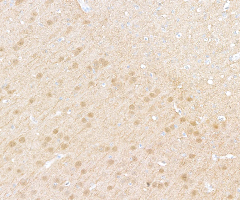 Immunohistochemistry - Anti-UCHL1 antibody [BLR216K] - BSA free (AB314058)