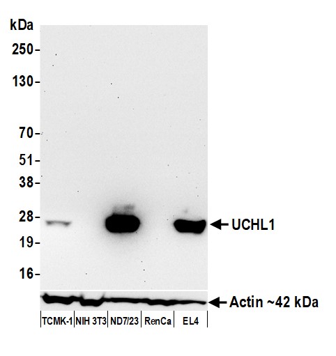 Western blot - Anti-UCHL1 antibody [BLR216K] - BSA free (AB314058), expandable thumbnail