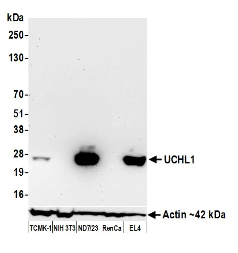 Western blot - Anti-UCHL1 antibody [BLR216K] - BSA free (AB314058)