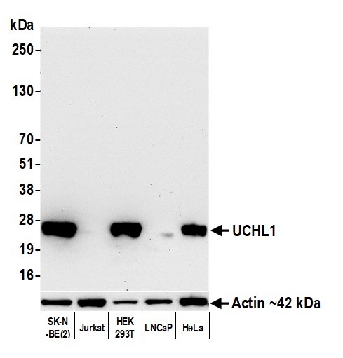 Western blot - Anti-UCHL1 antibody [BLR216K] - BSA free (AB314058), expandable thumbnail