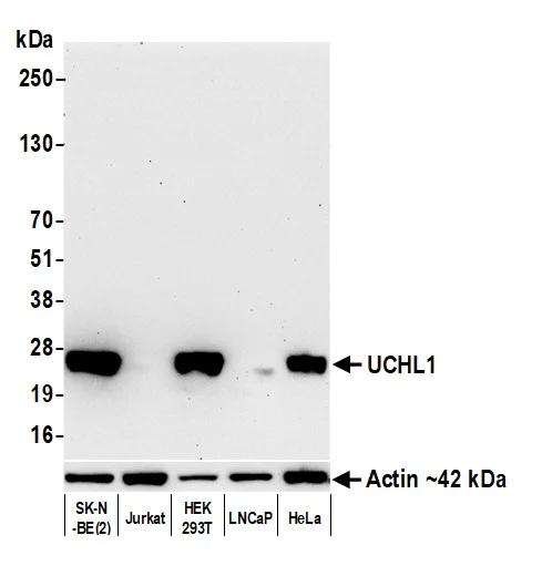 Western blot - Anti-UCHL1 antibody [BLR216K] - BSA free (AB314058)