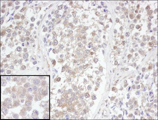 Immunohistochemistry (Formalin/PFA-fixed paraffin-embedded sections) - Anti-UCHL3 antibody (AB241490)