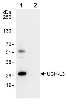 Immunoprecipitation - Anti-UCHL3 antibody (AB241490)