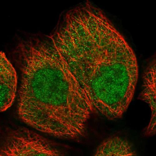 Immunocytochemistry/ Immunofluorescence - Anti-UCHL3 antibody (AB244371)