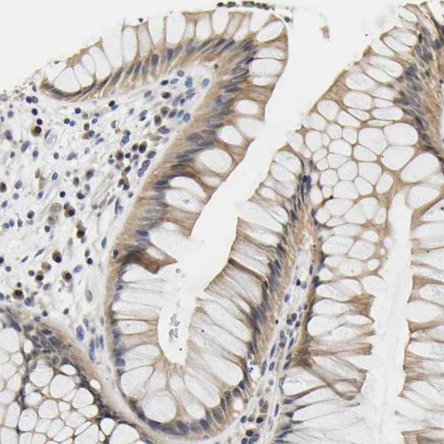 Immunohistochemistry (Formalin/PFA-fixed paraffin-embedded sections) - Anti-UCHL3 antibody (AB244371)