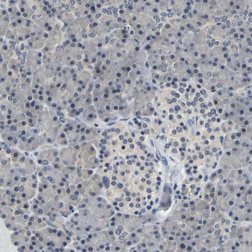 Immunohistochemistry (Formalin/PFA-fixed paraffin-embedded sections) - Anti-UCHL3 antibody (AB244371)