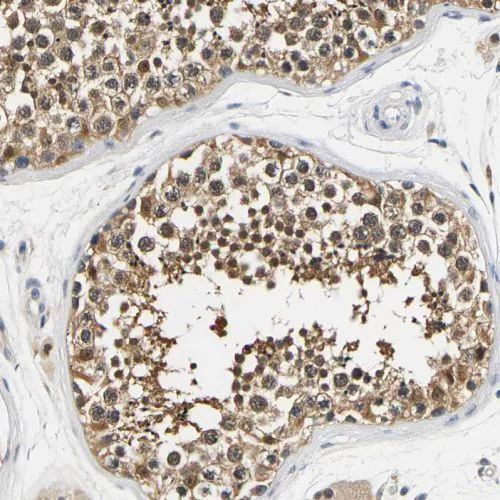 Immunohistochemistry (Formalin/PFA-fixed paraffin-embedded sections) - Anti-UCHL3 antibody (AB244371)