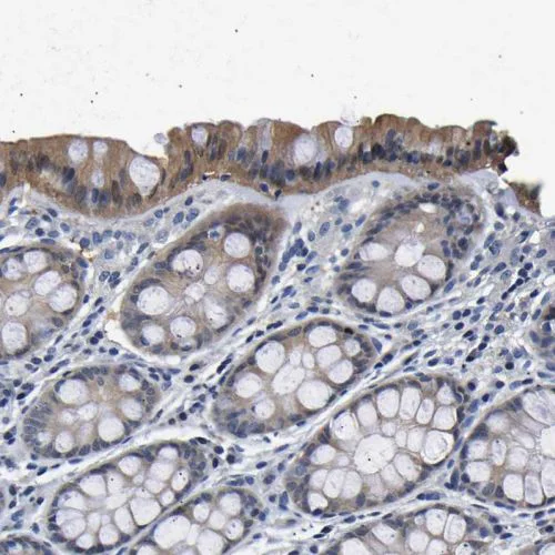 Immunohistochemistry (Formalin/PFA-fixed paraffin-embedded sections) - Anti-UCHL3 antibody (AB244371)