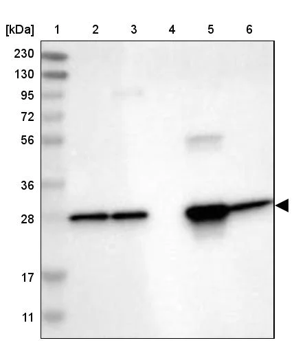 Western blot - Anti-UCHL3 antibody (AB244371)