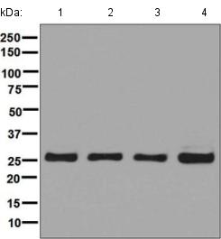Western blot - Anti-UCHL3 antibody [EP5331] (AB126621)