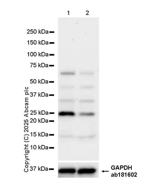 Western blot - Anti-UCHL3 antibody [EPR29841-548] (AB323384)