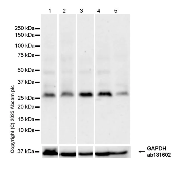 Western blot - Anti-UCHL3 antibody [EPR29841-548] (AB323384)