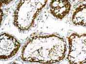 Immunohistochemistry (Formalin/PFA-fixed paraffin-embedded sections) - Anti-UCHL3 antibody [EPR5332] (AB126703)