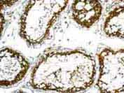 Immunohistochemistry (Formalin/PFA-fixed paraffin-embedded sections) - Anti-UCHL3 antibody [EPR5332] (AB126703)