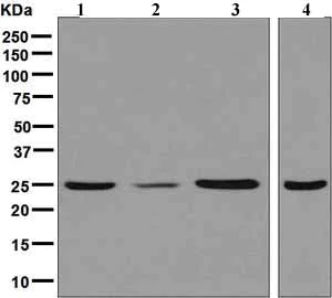 Western blot - Anti-UCHL3 antibody [EPR5332] (AB126703)