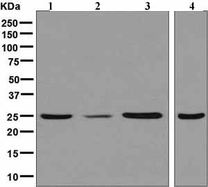 Western blot - Anti-UCHL3 antibody [EPR5332] - BSA and Azide free (AB248136)