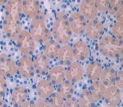 Immunohistochemistry (Formalin/PFA-fixed paraffin-embedded sections) - Anti-UCHL4 antibody (AB231352)