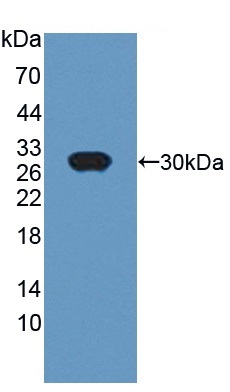 Western blot - Anti-UCHL4 antibody (AB231352), expandable thumbnail