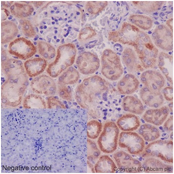 Immunohistochemistry (Formalin/PFA-fixed paraffin-embedded sections) - Anti-UCHL5IP antibody [EPR15341-56] (AB192616), expandable thumbnail