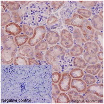 Immunohistochemistry (Formalin/PFA-fixed paraffin-embedded sections) - Anti-UCHL5IP antibody [EPR15341-56] (AB192616)