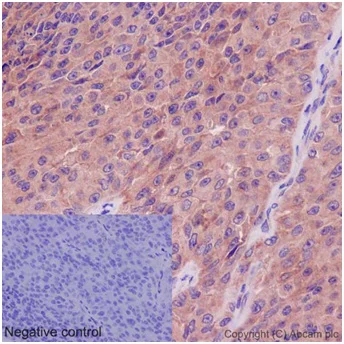 Immunohistochemistry (Formalin/PFA-fixed paraffin-embedded sections) - Anti-UCHL5IP antibody [EPR15341-56] (AB192616)