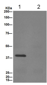 Immunoprecipitation - Anti-UCHL5IP antibody [EPR15341-56] (AB192616), expandable thumbnail