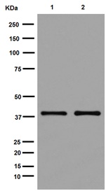 Western blot - Anti-UCHL5IP antibody [EPR15341-56] (AB192616), expandable thumbnail