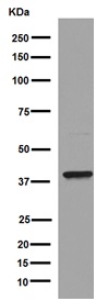 Western blot - Anti-UCHL5IP antibody [EPR15341-56] (AB192616), expandable thumbnail