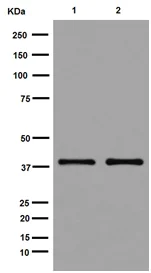 Western blot - Anti-UCHL5IP antibody [EPR15341-56] - BSA and Azide free (AB251147)