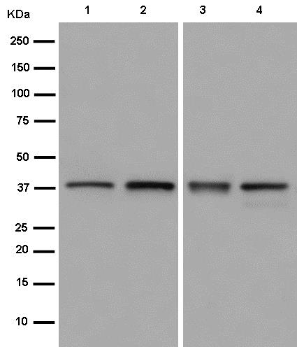 Western blot - Anti-UCHL5IP antibody [EPR15341] (AB186420)