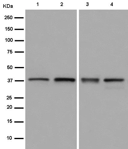 Western blot - Anti-UCHL5IP antibody [EPR15341] - BSA and Azide free (AB250877)