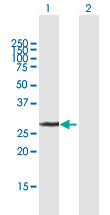 Western blot - Anti-UCK2 antibody (AB167683)
