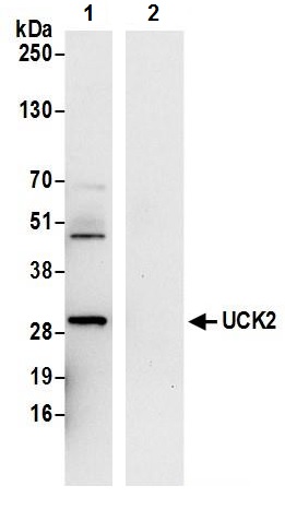 Immunoprecipitation - Anti-UCK2 antibody (AB241281), expandable thumbnail