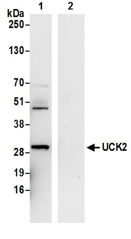 Immunoprecipitation - Anti-UCK2 antibody (AB241281)