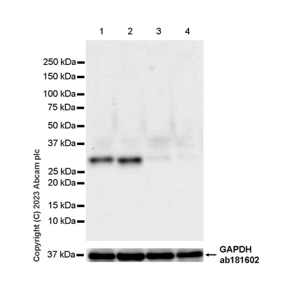 Western blot - Anti-UCK2 antibody [EPR27020-82] - BSA and Azide free (AB308253)
