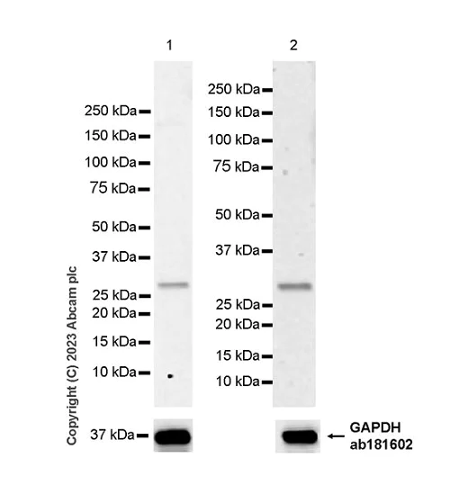 Western blot - Anti-UCK2 antibody [EPR27020-82] - BSA and Azide free (AB308253)