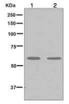 Western blot - Anti-UCKL1 antibody [EPR7384] (AB126754)