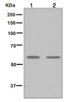 Western blot - Anti-UCKL1 antibody [EPR7384] - BSA and Azide free (AB248168), expandable thumbnail