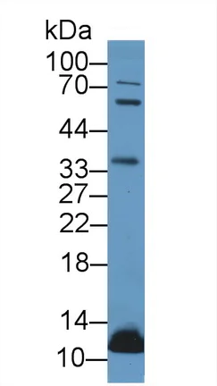 Western blot - Anti-UCN2/SRP antibody (AB231050)