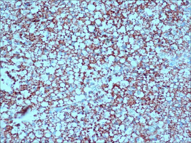 Immunohistochemistry (Formalin/PFA-fixed paraffin-embedded sections) - Anti-UCP1 antibody (AB10983)