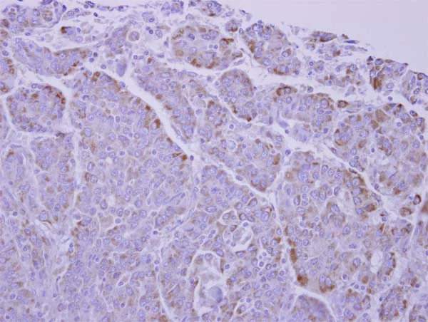 Immunohistochemistry (Formalin/PFA-fixed paraffin-embedded sections) - Anti-UCP1 antibody (AB155117)
