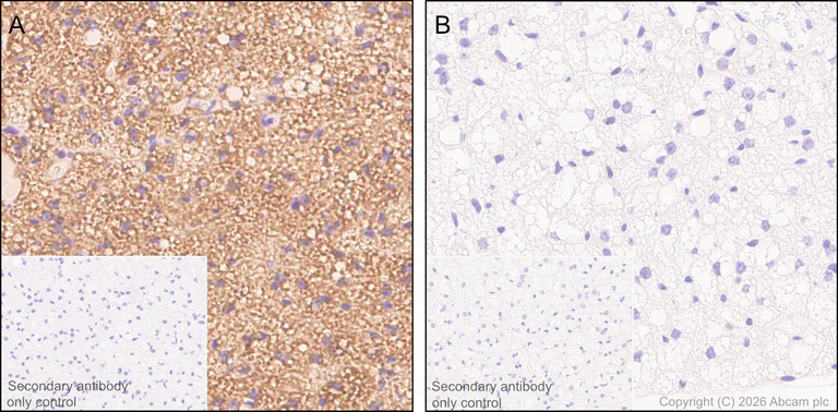 Immunohistochemistry (Formalin/PFA-fixed paraffin-embedded sections) - Anti-UCP1 antibody [RM1066] (AB314239)
