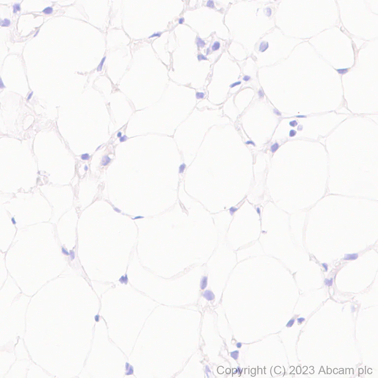 Immunohistochemistry (Formalin/PFA-fixed paraffin-embedded sections) - Anti-UCP1 antibody [RM1066] - BSA and Azide free (AB314240)