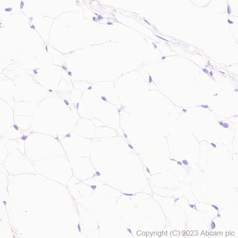 Immunohistochemistry (Formalin/PFA-fixed paraffin-embedded sections) - Anti-UCP1 antibody [RM1066] - BSA and Azide free (AB314240)
