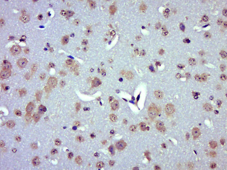 Immunohistochemistry (Formalin/PFA-fixed paraffin-embedded sections) - Anti-UCP2 antibody (AB203244)