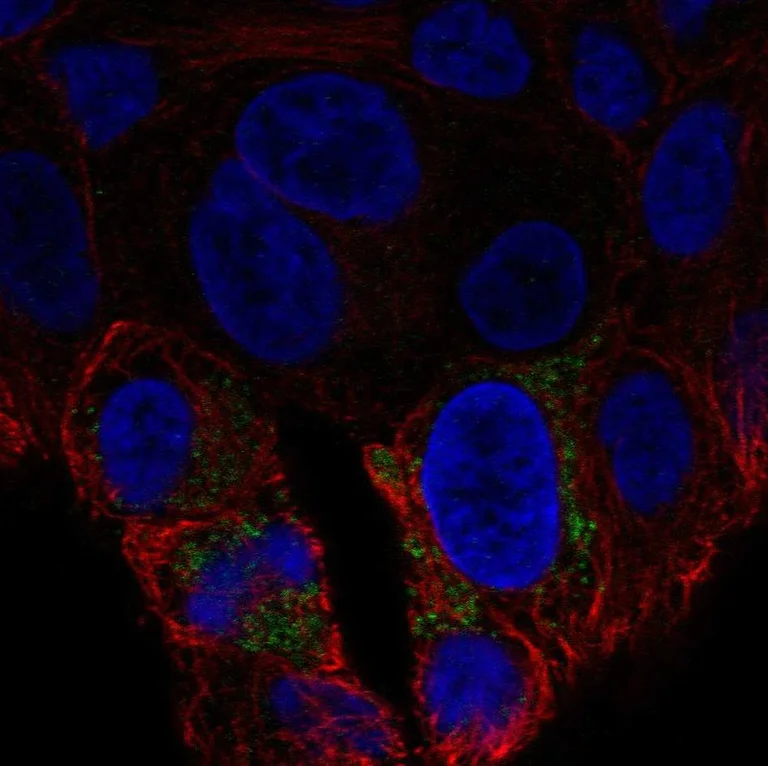 Immunocytochemistry/ Immunofluorescence - Anti-UCP2 antibody (AB247184)