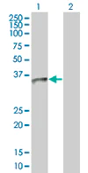 Western blot - Anti-UCP2 antibody (AB67241)