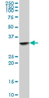 Western blot - Anti-UCP2 antibody (AB67241)