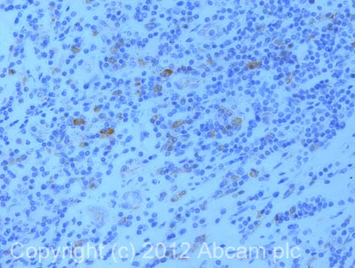 Immunohistochemistry (Formalin/PFA-fixed paraffin-embedded sections) - Anti-UCP2 antibody (AB97931)